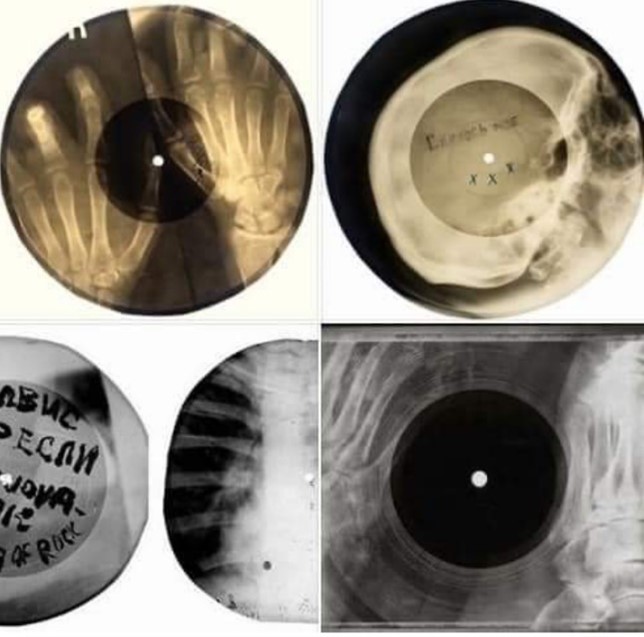 Discos de radiografías